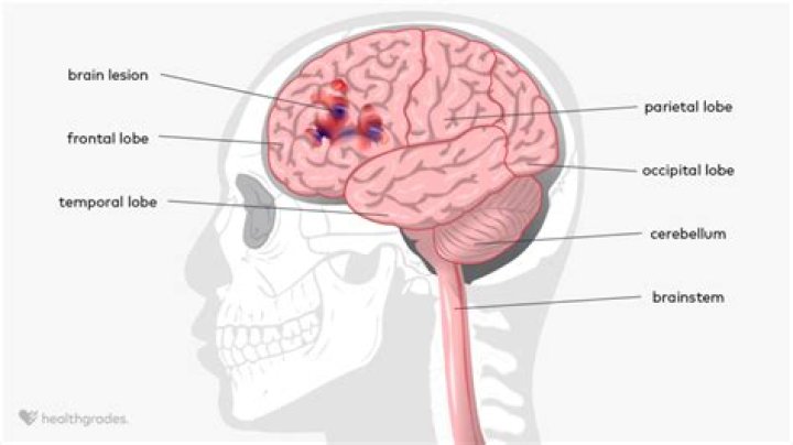 Can doctors check for brain damage?