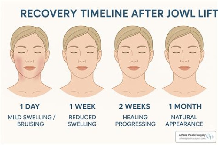 How can I reverse my ITC?