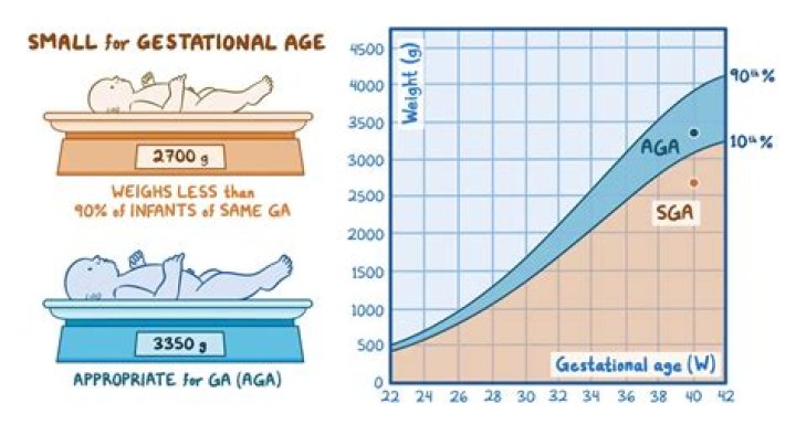 How is SGA calculated?