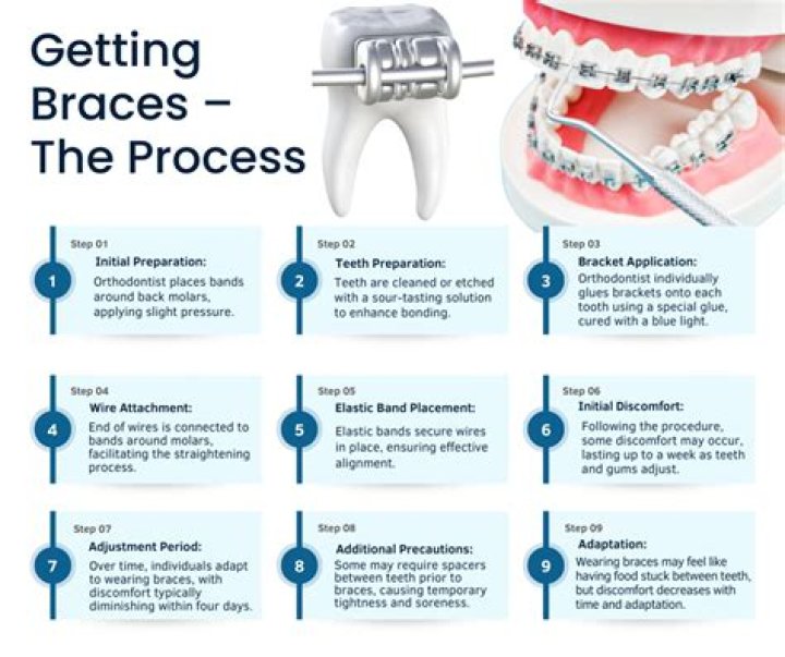 How long does the process of retiring take?
