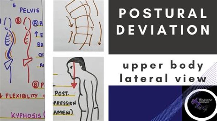 What are postural limitations?