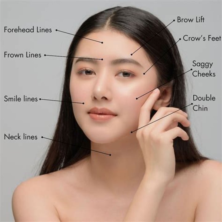 What are the lines on a W-2?