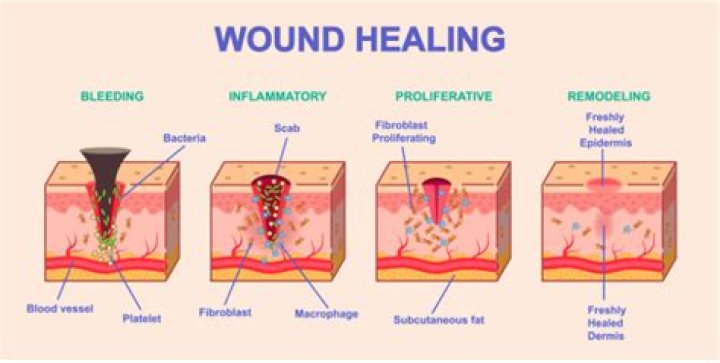 What wound takes longer to heal?